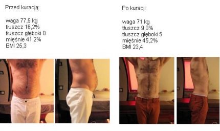 Odchudzanie, program CellReset, zdjęcie przed i po
